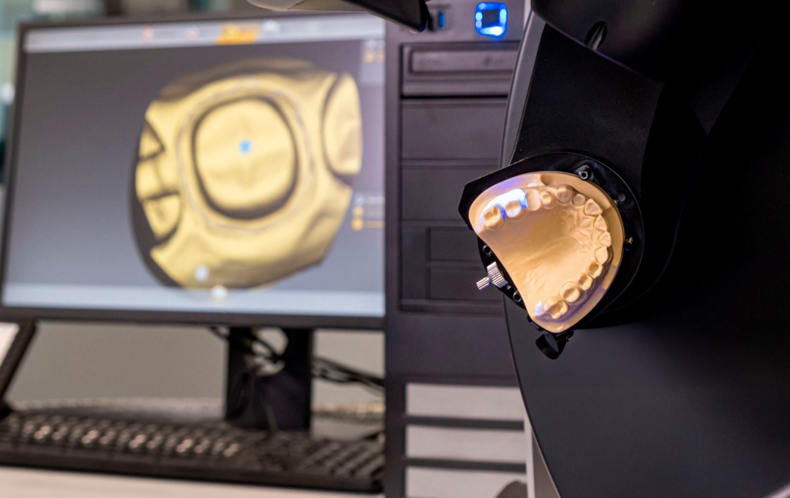 Ventajas tecnología Cad Cam