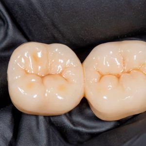 laboratorio dental zirconio