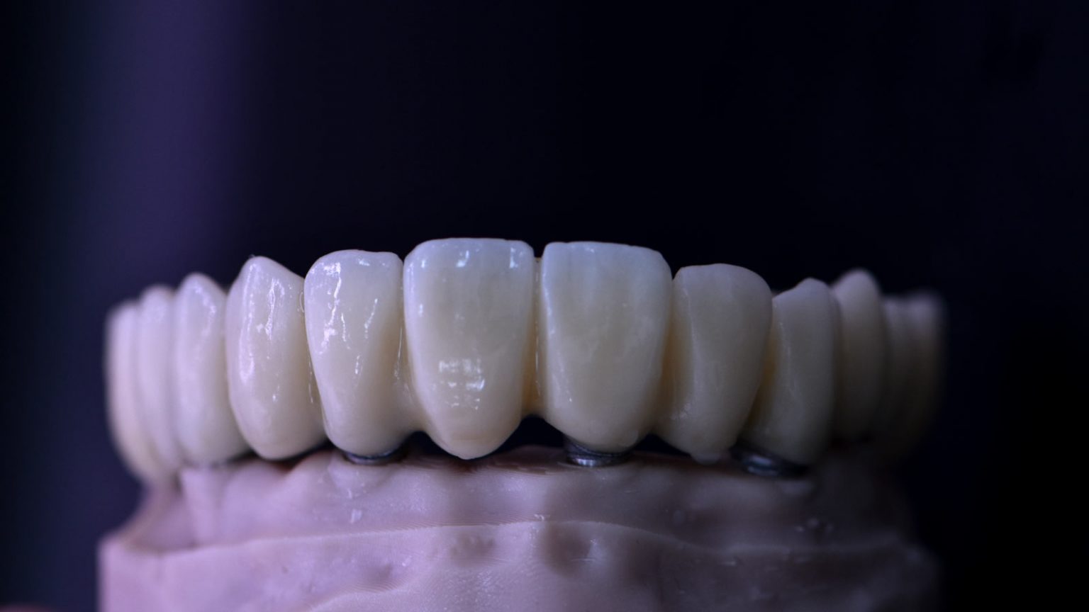 Zirconio en Odontología: Revolución en Estética y Durabilidad