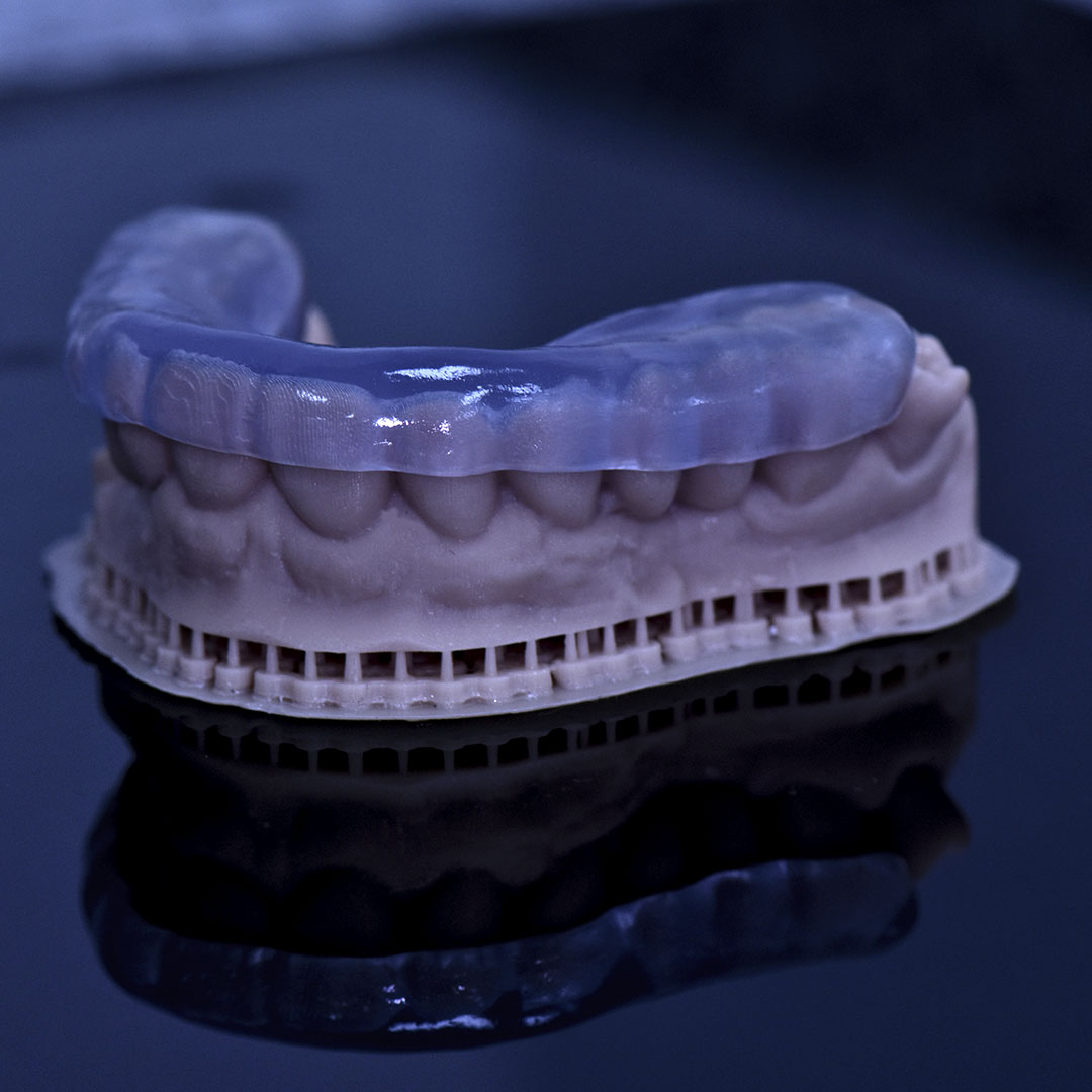 Férulas dentales digitales: bruxismo, Essix de ortodoncia y blanqueamiento