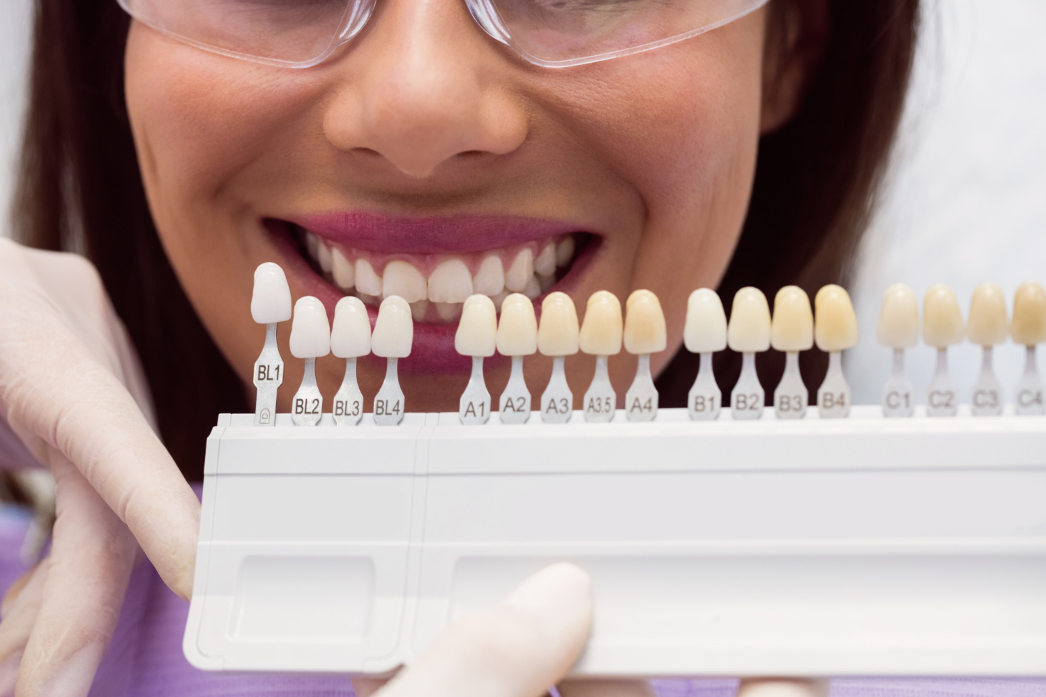Usos de la Resina en el Laboratorio Dental Digital