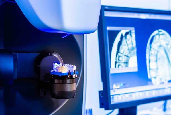 Laboratorio de Prótesis Dental en Alicante