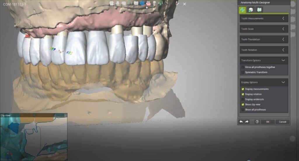 Laboratorio Dental CAD-CAM en Alicante: ¿Cómo elegir el mejor partner protésico para tu clínica?