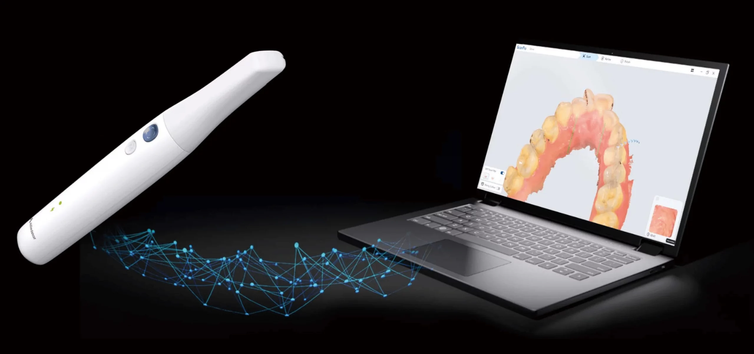 Laboratorio compatible con escáner intraoral en Alicante