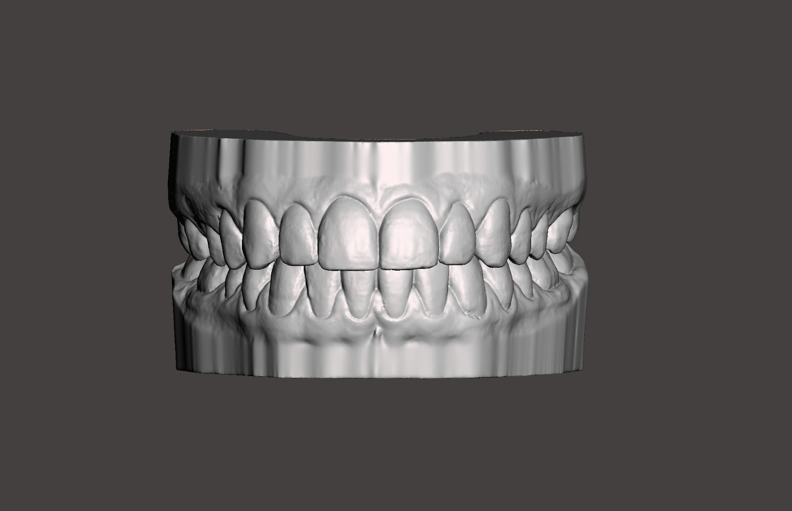 Del archivo STL a la prótesis definitiva: todo el recorrido dentro de un laboratorio dental digital