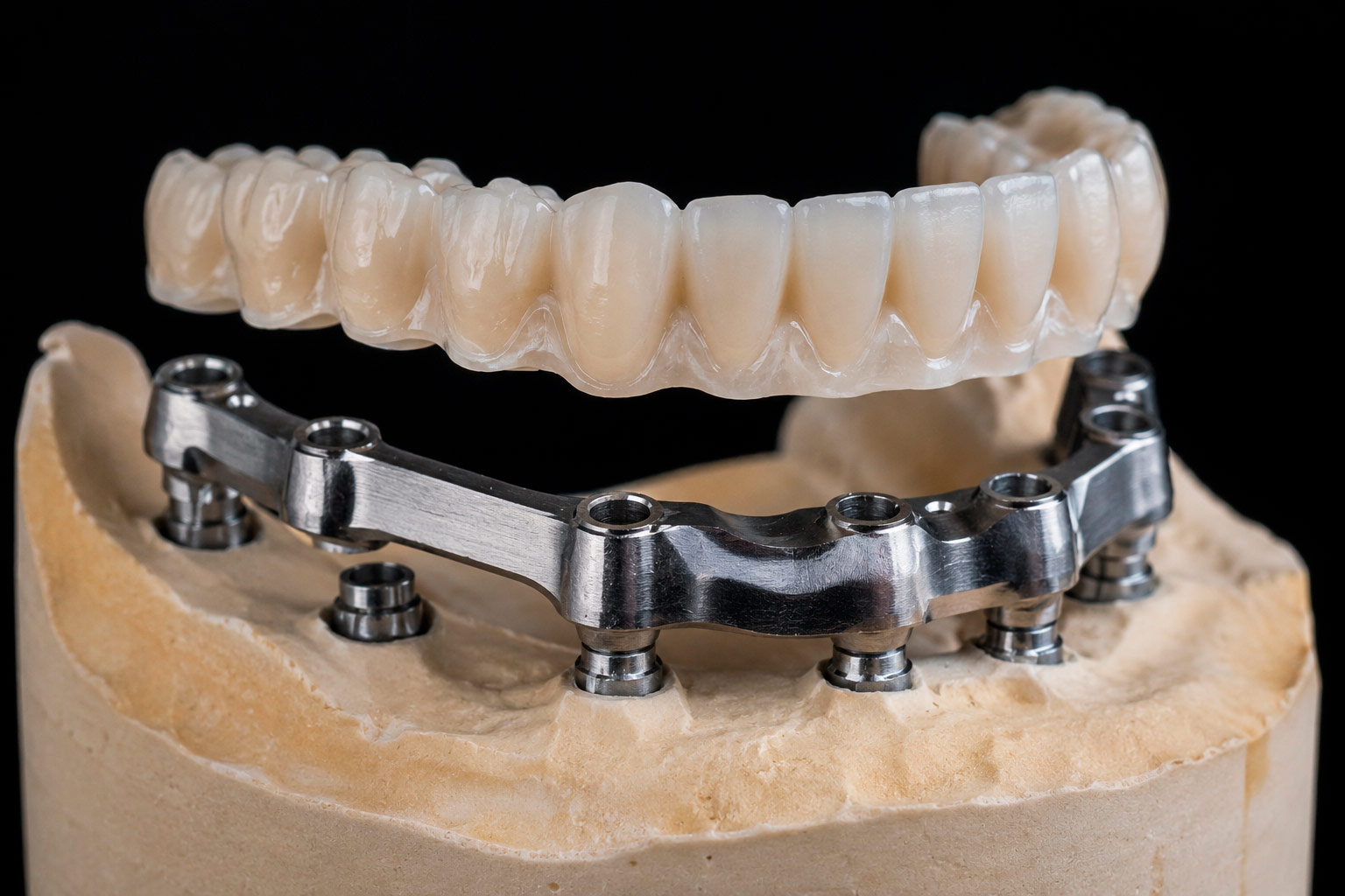 ¿Qué es el ajuste pasivo y por qué determina el éxito de una rehabilitación sobre implantes?